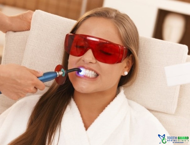 تبييض الاسنان بالليزر